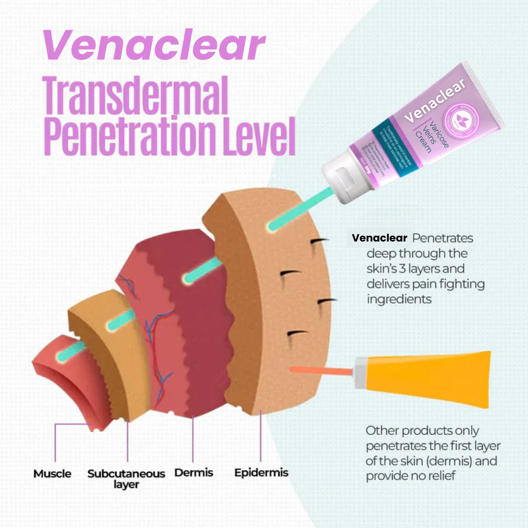 Venaclear™ Varicose Veins Cream