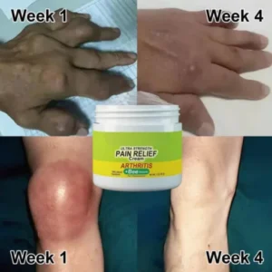 Zealand’s Bee Venom Joint and Bone Therapy Cream