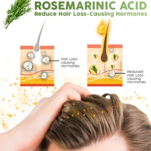 flysmus™ Rosemary Multi-Peptide Hair Growth Serum