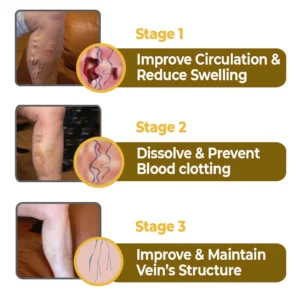 flysmus™ VaricoX Vein Dredge Bee Venom Spray