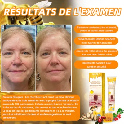 𝐖𝐑𝐄𝐄™ 𝐂𝐫è𝐦𝐞 𝐝'é𝐥𝐢𝐦𝐢𝐧𝐚𝐭𝐢𝐨𝐧 𝐝𝐞𝐬 𝐯𝐞𝐫𝐫𝐮𝐞𝐬 𝐞𝐭 𝐝𝐞𝐬 𝐭𝐚𝐠𝐬 𝐚𝐮 𝐯𝐞𝐧𝐢𝐧 𝐝'𝐚𝐛𝐞𝐢𝐥𝐥𝐞