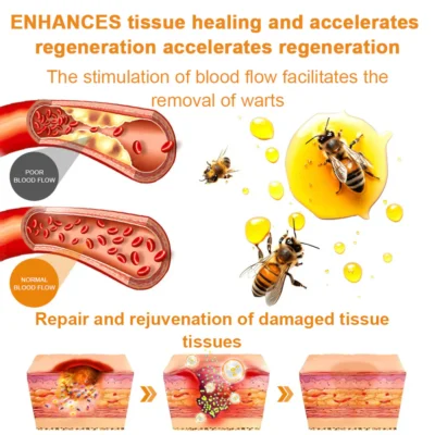 𝗥𝗮𝗶𝗻𝗱𝗲𝘄™ 𝗕𝗲𝗲 𝗩𝗲𝗻𝗼𝗺 𝗪𝗮𝗿𝘁 𝗧𝗿𝗲𝗮𝘁𝗺𝗲𝗻𝘁 𝗖𝗿𝗲𝗮𝗺
