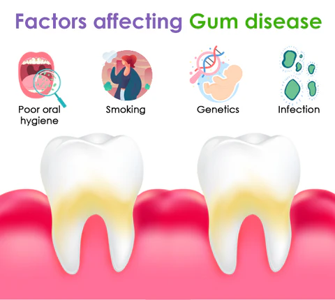 AEXZR™ Gum Treatment Foam
