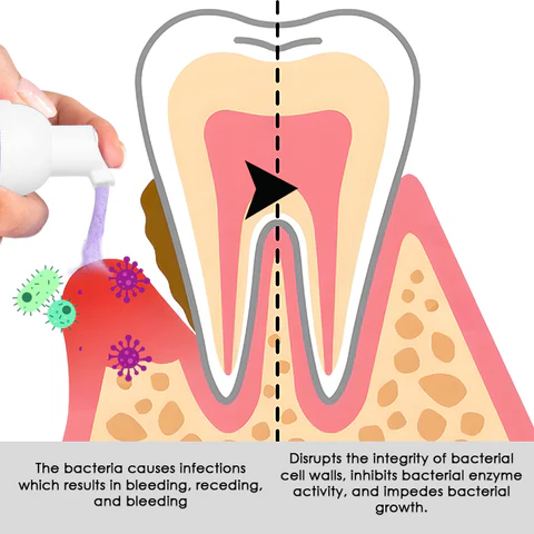 AEXZR™ Gum Treatment Foam