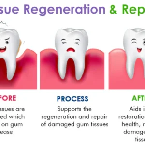AEXZR™ Gum Treatment Foam