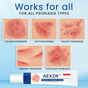 AEXZR™ Psoriasis Treatment Cream