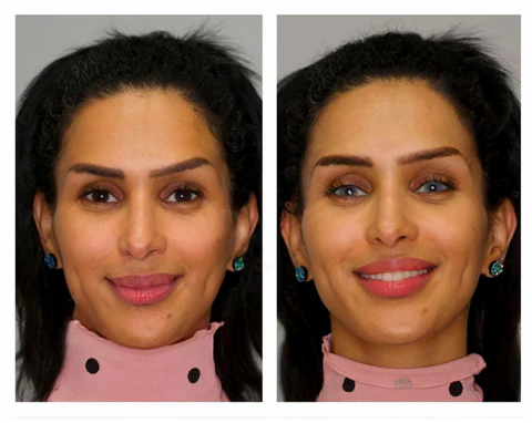 EyesChroma™ Color Shift Eye Drops