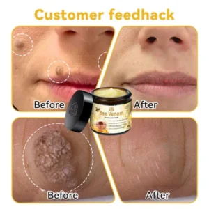 Furzero™ Bee Venom Skin Treatment Cream