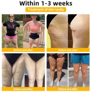 Fuzero™ Firm Skin Tighten Cream