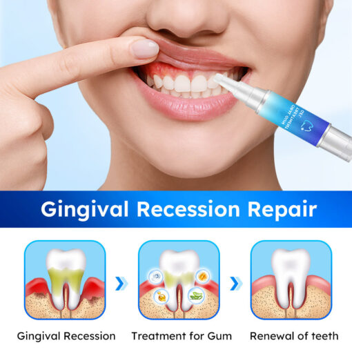 LOVILDS™ Oral Gum Treatment Gel