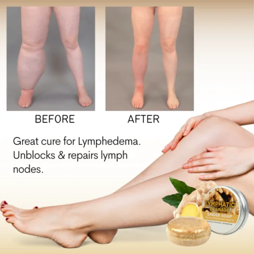 LymphaticDrainage Ginger Soap