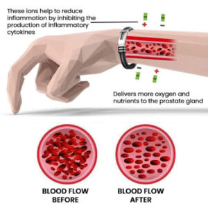 Oveallgo™ ProstaVital Magnetic Copper Wristband