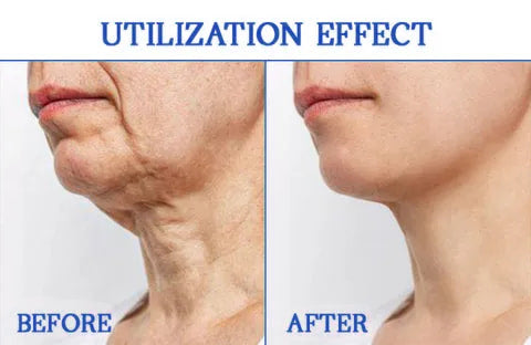 TotalLift BodyRenew Luxe Firming Cream for Crepey Skin