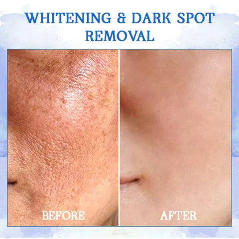 TotalLift BodyRenew Luxe Firming Cream for Crepey Skin