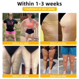 𝐄𝐝𝐢𝐉𝐨𝐧𝐚𝐡™ 𝐀𝐝𝐯𝐚𝐧𝐜𝐞𝐝 𝐅𝐢𝐫𝐦𝐢𝐧𝐠 & 𝐖𝐫𝐢𝐧𝐤𝐥𝐞-𝐑𝐞𝐝𝐮𝐜𝐢𝐧𝐠 𝐂𝐫𝐞𝐚𝐦
