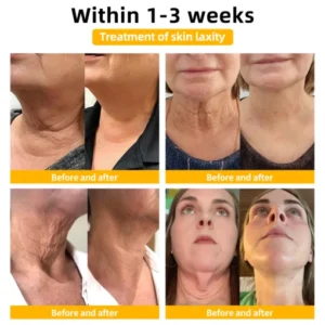 𝐄𝐝𝐢𝐉𝐨𝐧𝐚𝐡™ 𝐀𝐝𝐯𝐚𝐧𝐜𝐞𝐝 𝐅𝐢𝐫𝐦𝐢𝐧𝐠 & 𝐖𝐫𝐢𝐧𝐤𝐥𝐞-𝐑𝐞𝐝𝐮𝐜𝐢𝐧𝐠 𝐂𝐫𝐞𝐚𝐦