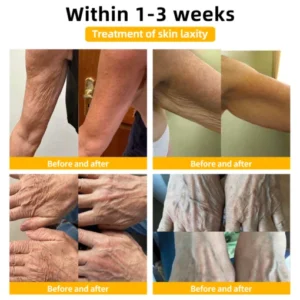 𝐄𝐝𝐢𝐉𝐨𝐧𝐚𝐡™ 𝐀𝐝𝐯𝐚𝐧𝐜𝐞𝐝 𝐅𝐢𝐫𝐦𝐢𝐧𝐠 & 𝐖𝐫𝐢𝐧𝐤𝐥𝐞-𝐑𝐞𝐝𝐮𝐜𝐢𝐧𝐠 𝐂𝐫𝐞𝐚𝐦