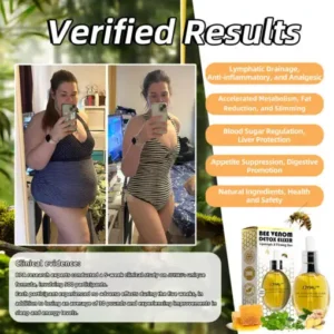 𝐉𝐎𝐘𝐈𝐀𝐔™ 𝐁𝐞𝐞 𝐕𝐞𝐧𝐨𝐦 𝐃𝐞𝐭𝐨𝐱 𝐄𝐥𝐢𝐱𝐢𝐫 – 𝐋𝐢𝐩𝐨𝐭𝐫𝐨𝐩𝐢𝐜 & 𝐅𝐢𝐫𝐦𝐢𝐧𝐠 𝐃𝐮𝐨