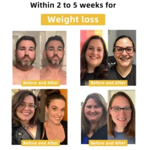 𝐉𝐎𝐘𝐈𝐀𝐔™ 𝐁𝐞𝐞 𝐕𝐞𝐧𝐨𝐦 𝐃𝐞𝐭𝐨𝐱 𝐄𝐥𝐢𝐱𝐢𝐫 – 𝐋𝐢𝐩𝐨𝐭𝐫𝐨𝐩𝐢𝐜 & 𝐅𝐢𝐫𝐦𝐢𝐧𝐠 𝐃𝐮𝐨