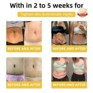 𝐉𝐎𝐘𝐈𝐀𝐔™ 𝐁𝐞𝐞 𝐕𝐞𝐧𝐨𝐦 𝐃𝐞𝐭𝐨𝐱 𝐄𝐥𝐢𝐱𝐢𝐫 – 𝐋𝐢𝐩𝐨𝐭𝐫𝐨𝐩𝐢𝐜 & 𝐅𝐢𝐫𝐦𝐢𝐧𝐠 𝐃𝐮𝐨