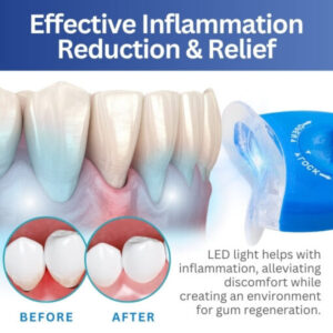 AEXZR­™ LED Light Gum Repair