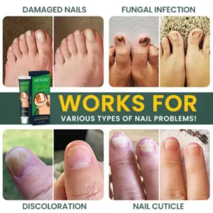 AEXZR™ Nail Care Anti Fungal Cream