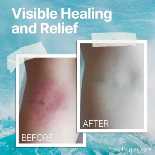 AEXZR™ Ocean Healed Eczema Soothing Cream