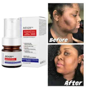 AEXZR™ Vitamin C Whitening Freckles Face Cream Remove Melasma Dark Spots Lighten Melanin