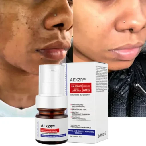AEXZR™ Vitamin C Whitening Freckles Face Cream Remove Melasma Dark Spots Lighten Melanin