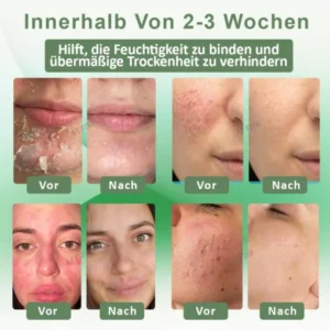 ATTDX™ Wiederauferstehungsgras Hautberuhigende