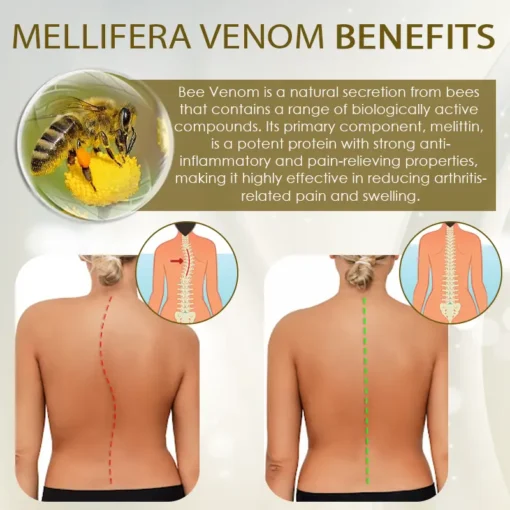FLYCARE™ Mellifera Venom BoneSooth DX Treatment Cream