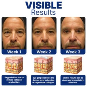 Furzero™ Peptide Ultrasonic Eye Treatment