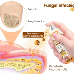Ourlyard™ Bee Venom Nail Fungus Spray