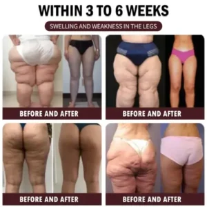 𝐀𝐫𝐭𝐡𝐫𝐨𝐅𝐫𝐞𝐞™𝐁𝐞𝐞-𝐕𝐞𝐧𝐨𝐦 𝐏𝐚𝐢𝐧-𝐑𝐞𝐥𝐢𝐞𝐟 𝐁𝐨𝐧𝐞 𝐇𝐞𝐚𝐥𝐢𝐧𝐠 𝐂𝐫𝐞𝐚𝐦