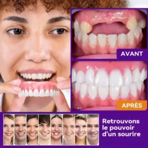 𝐁𝐢𝐤𝐞𝐧𝐝𝐚™ 𝐄𝐧𝐬𝐞𝐦𝐛𝐥𝐞 𝐃𝐞 𝐃𝐞𝐧𝐭𝐢𝐞𝐫𝐬 𝐄𝐧 𝐒𝐢𝐥𝐢𝐜𝐨𝐧𝐞