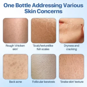 Biancat™ FrostCure Winter Cracked Skin Healing Cream