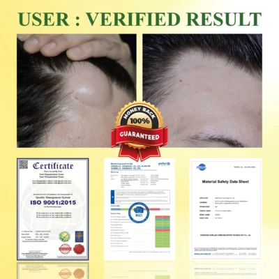 DetoxFlow™ Lymphatic Support SwellingEase Oil