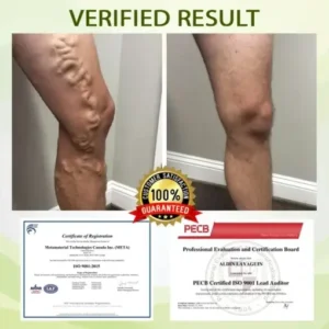 DetoxFlow™ SwellFree Lymphatic Herbal Cream