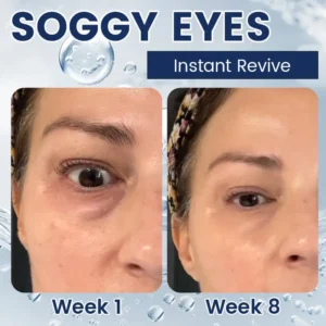 Dobshow α-Arbutin 2% ＋CRFs Eye Repair Cream