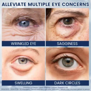 Dobshow α-Arbutin 2% ＋CRFs Eye Repair Cream