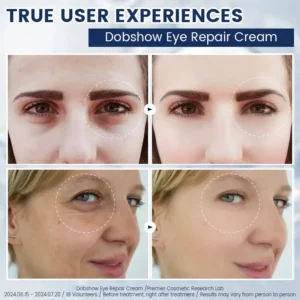 Dobshow α-Arbutin 2% ＋CRFs Eye Repair Cream