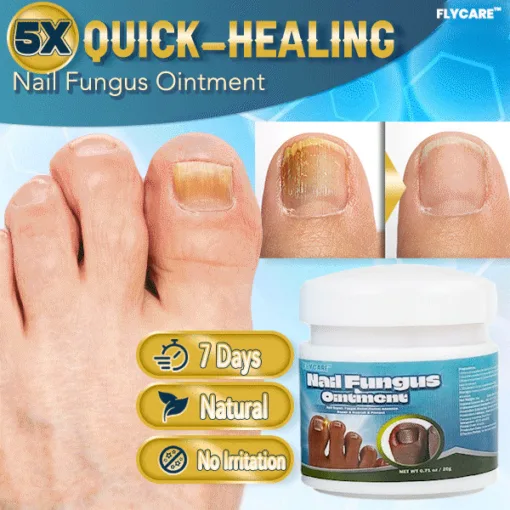 FLYCARE™ 5X QUICK-HEALING Nail Fungus Ointment