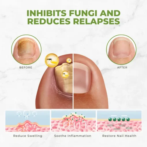 Flycare™ FungiVanish Bee Venom Nail Treatment Oil