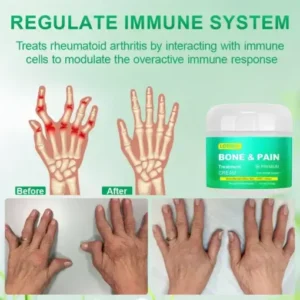 Lotmay® Boswellia Bone&Pain Treatment Cream