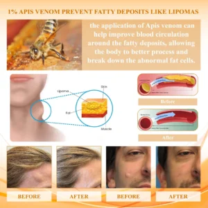 LumpFix™ Apis Venom LymphSupport Roll On
