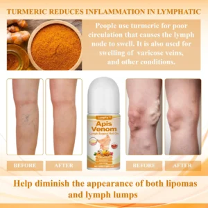 LumpFix™ Apis Venom LymphSupport Roll On