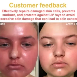 RTSSKE™ Bee Venom Skin Cream