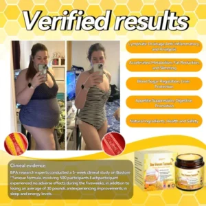SPZV™ Bee Venom Turmeric Detox Slimming Cream