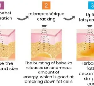 Ultrasonic Detox Watch Nurbini™ – Energy Balance