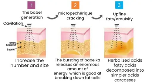 Ultrasonic Detox Watch Nurbini™ – Energy Balance